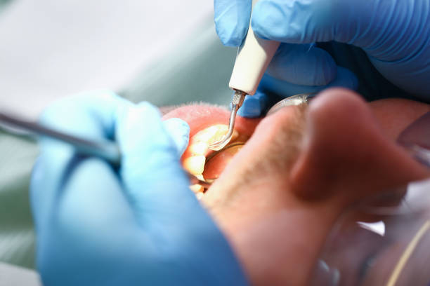 Best Emergency Dental Care for Broken or Chipped Teeth in Shepherdsville, KY