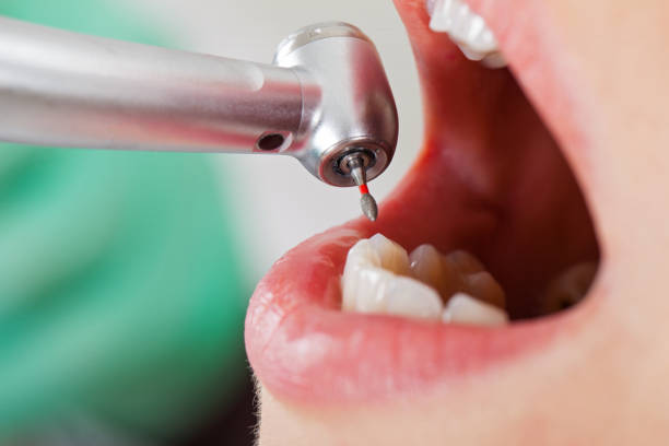 Best Emergency Gum Treatment in Shepherdsville, KY